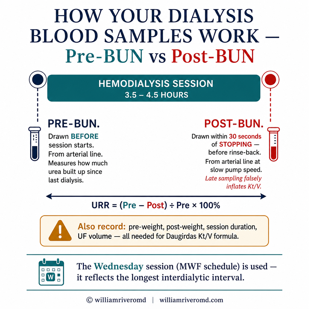 Pre-BUN vs Post-BUN blood draw technique for dialysis adequacy: timeline showing session start pre-draw and end post-draw within 30 seconds of stopping, URR formula, Kt/V inputs