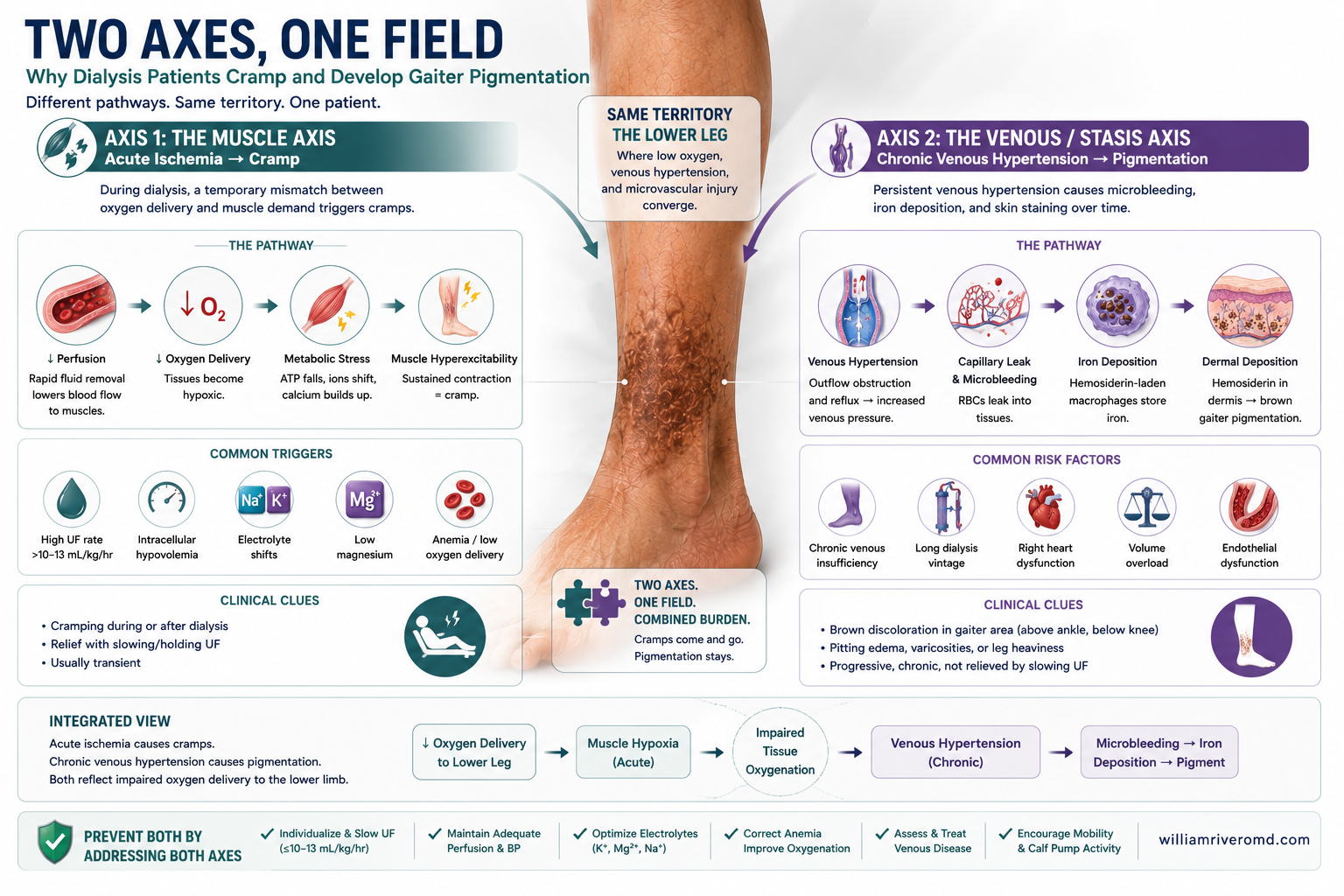 Two-panel comparison showing the acute axis (intradialytic cramp) and chronic axis (brown gaiter pigmentation) descending from a single shared upstream field of lower-limb hypoxia.