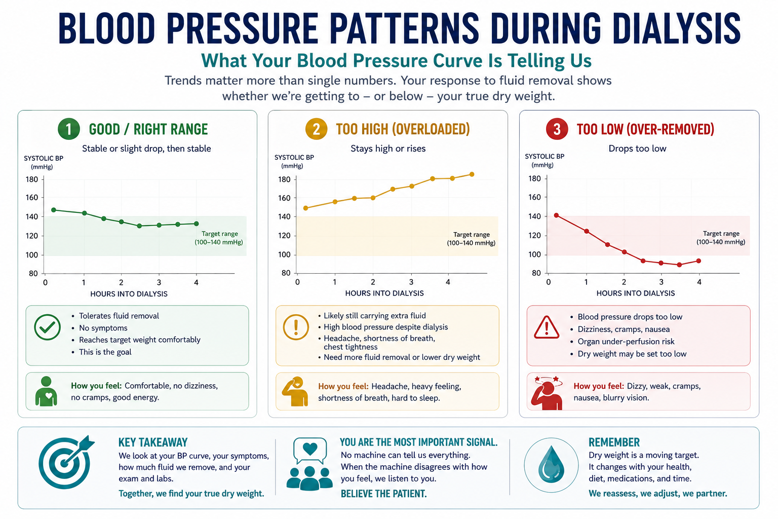 Three line graphs comparing blood pressure across a dialysis session. Curve 1, Tolerated: a steady, nearly flat line staying in the normal range from start to finish. Curve 2, Late crash: a line that holds normal at first then drops sharply near the end of the session, marking ultrafiltration that is too aggressive or probing below the true dry weight. Curve 3, Sustained high blood pressure: a line that stays elevated through the whole session, marking a patient sitting above dry weight.