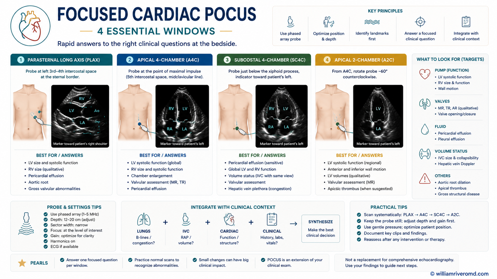 Figure 7 — Focused cardiac POCUS, four windows in a 2×2 grid. PLAX (LV, MV/AV, pericardium), PSAX mid-papillary (LV cavity geometry, D-shaped septum), A4C (all four chambers, RV:LV ratio), and subcostal (rescue view + IVC). Each panel carries a small torso inset showing probe placement and orientation marker.