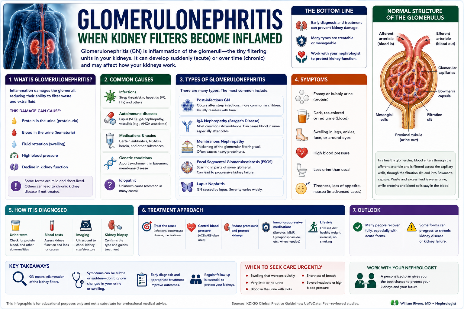 Glomerulonephritis overview: causes, types, symptoms, diagnosis, treatment, and normal glomerulus structure