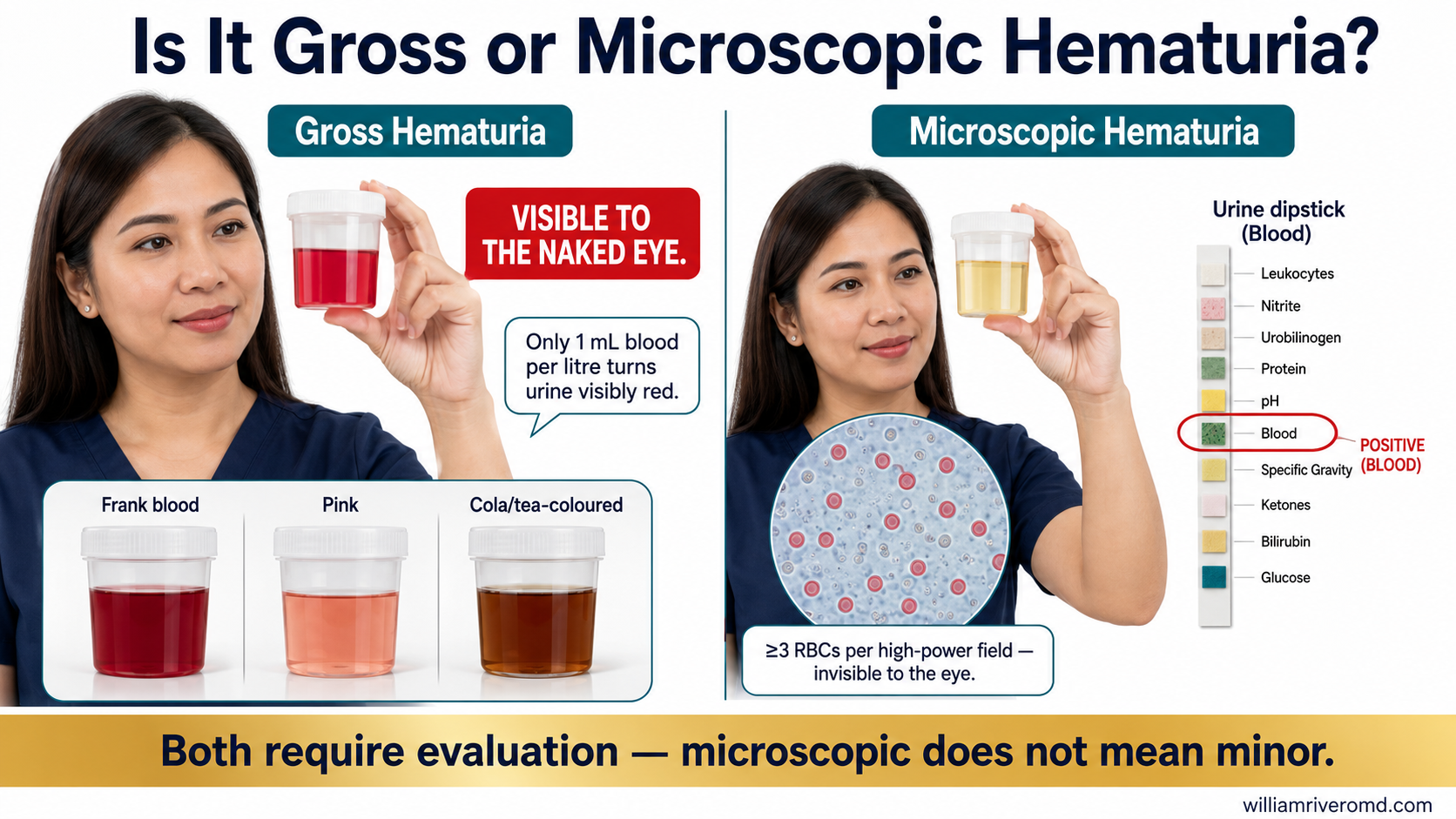 Is It Gross or Microscopic Hematuria? — comparison infographic showing visible red urine versus clear urine with dipstick and microscopy, Filipino patient model