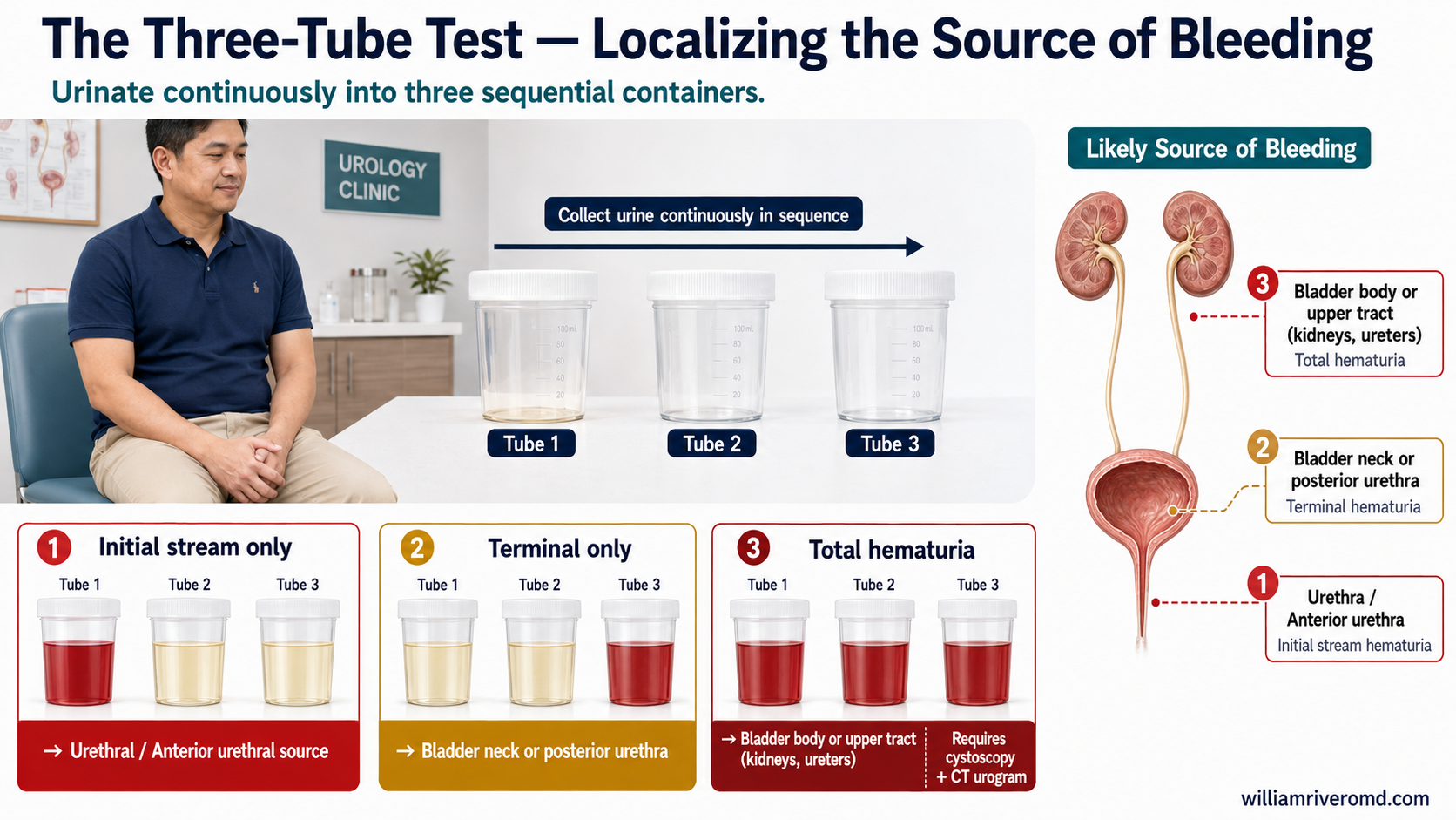 The Three-Tube Test — localizing the source of bleeding with three sequential urine collection containers, Filipino male patient in urology clinic, anatomical diagram