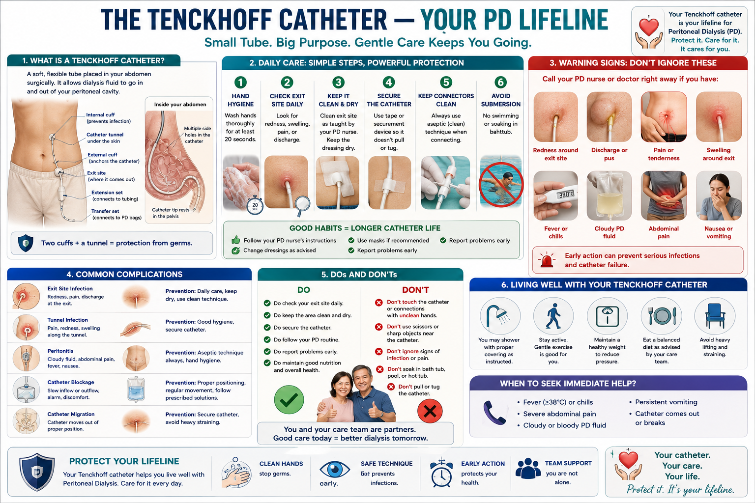 The Tenckhoff catheter — what it is, daily care steps, warning signs, common complications, dos and don'ts, and living well on PD
