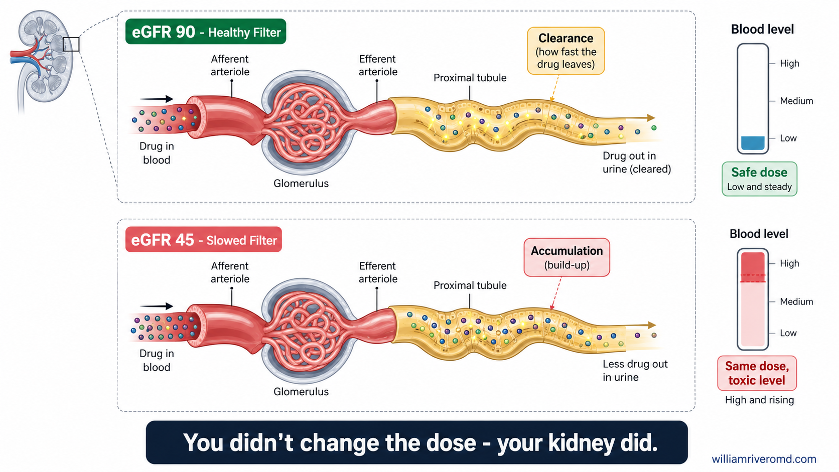 Renal clearance and drug accumulation diagram — a healthy eGFR 90 filter clears a drug briskly while a slowed eGFR 45 filter lets the same dose build to a toxic blood level, by W Rivero, MD