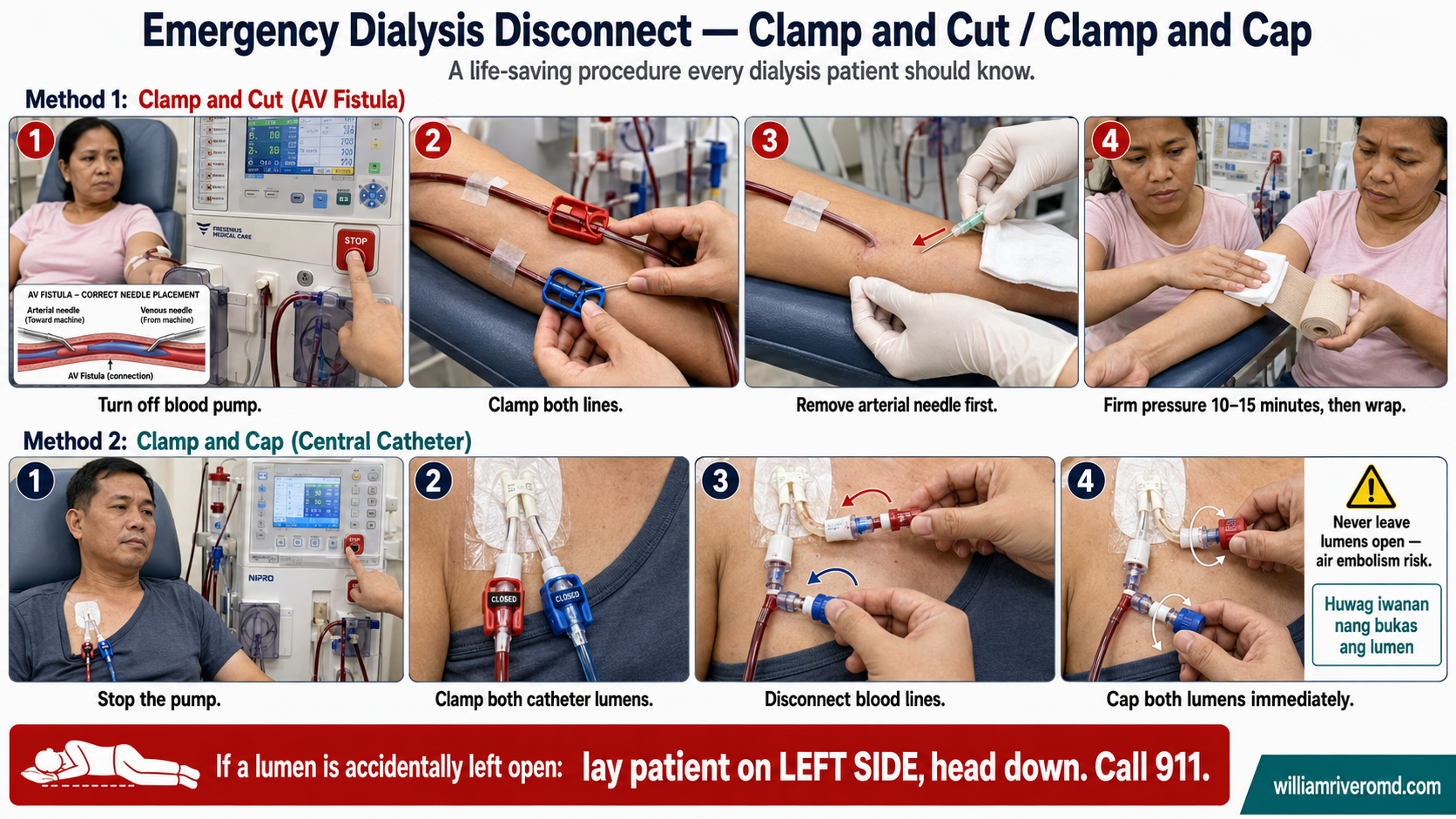 Emergency Dialysis Disconnect procedural infographic — Clamp and Cut for AV fistula patients and Clamp and Cap for central catheter patients, step-by-step with Filipino patient models
